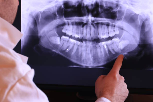 Best Emergency Dental Care for Broken or Chipped Teeth in Connell, WA