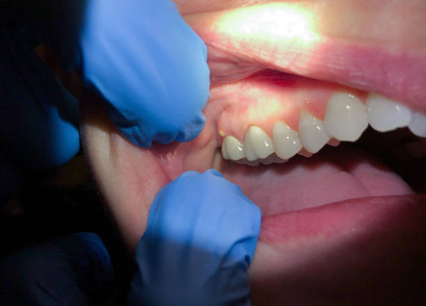 Best Pediatric Emergency Dentist in Connell, WA