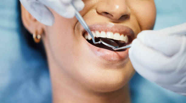 Best After-Hours Dental Trauma Care in Connell, WA